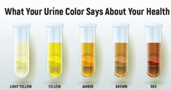 Does coffee dilute urine for pregnancy test