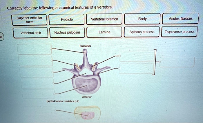 Correctly label the following anatomical features of a vertebra.