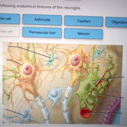 Label correctly features anatomical following intervertebral disc solved surrounding its help exit submit save transcribed problem text been show has