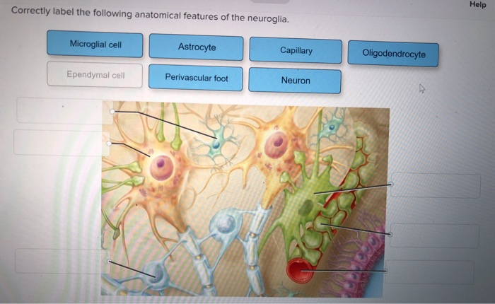 Label correctly features anatomical following intervertebral disc solved surrounding its help exit submit save transcribed problem text been show has